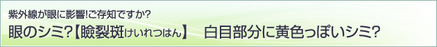 紫外線が眼に影響！ご存知ですか？眼のシミ？【瞼裂斑けいれつはん】白目部分に黄色っぽいシミ？